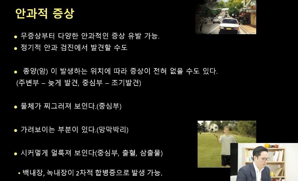 눈속의점-안구종양-명의-김민-교수