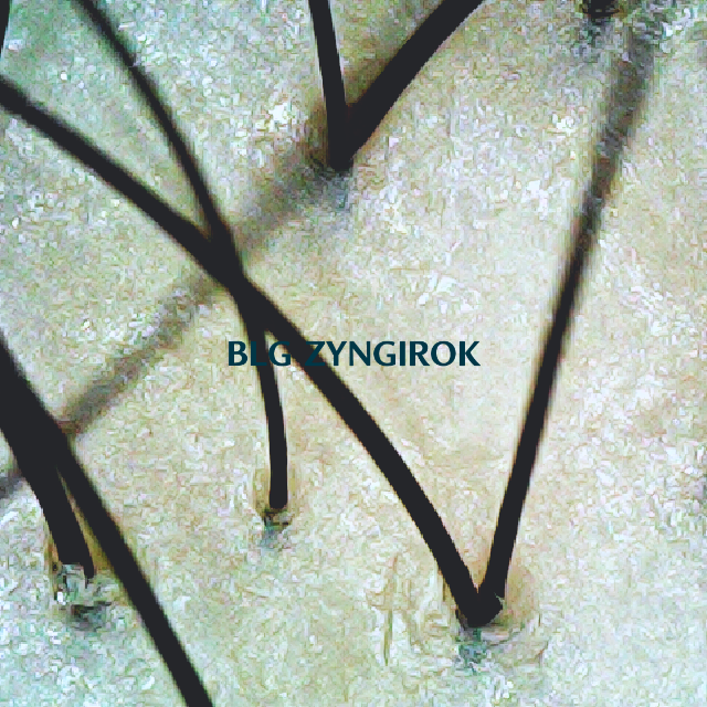 피나모아 복용 4주차 정수리 두피 모발 사진이다.