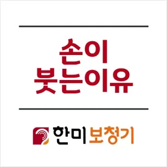 손등 붓는 이유 혈액순환 문제 증상과 해결법 정리_23