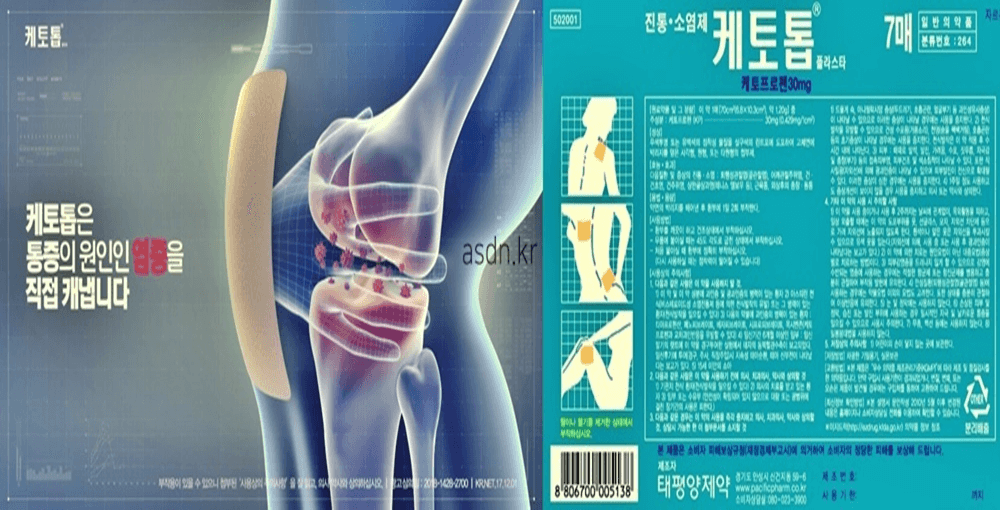 케토톱 효능 효과,성분,가격,부작용 총정리