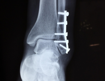 수술적 치료 예시