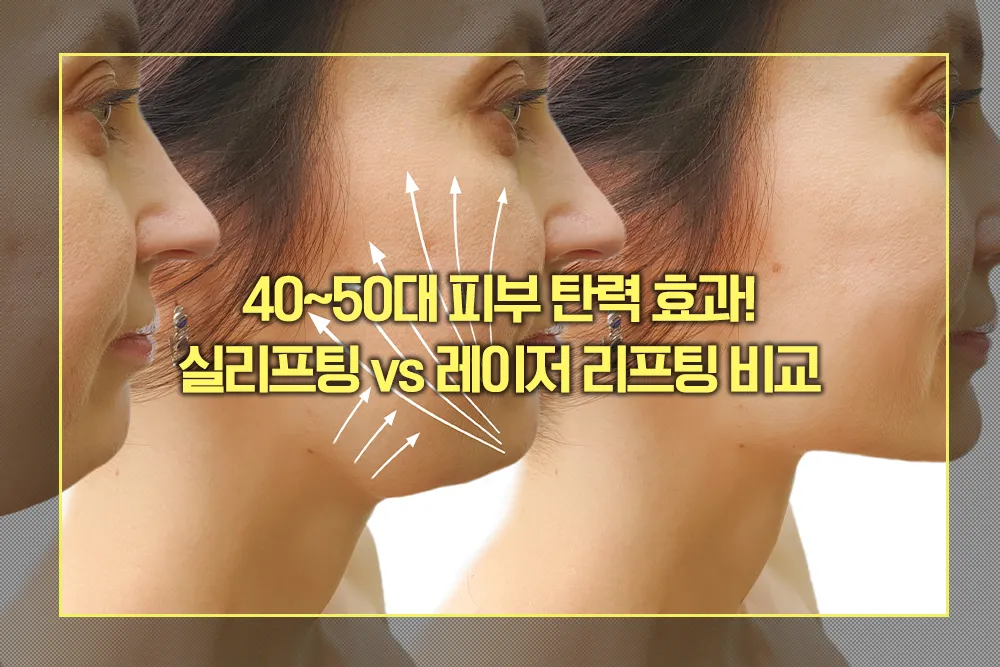 피부 탄력 실리프팅 vs 레이저 리프팅 비교