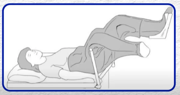 치질 수술 자세 중 하나로 쇄석 자세