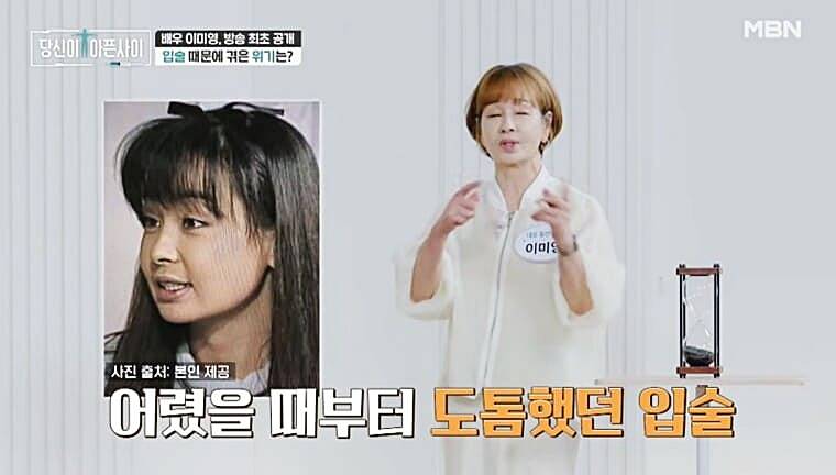 배우-이미영-입술