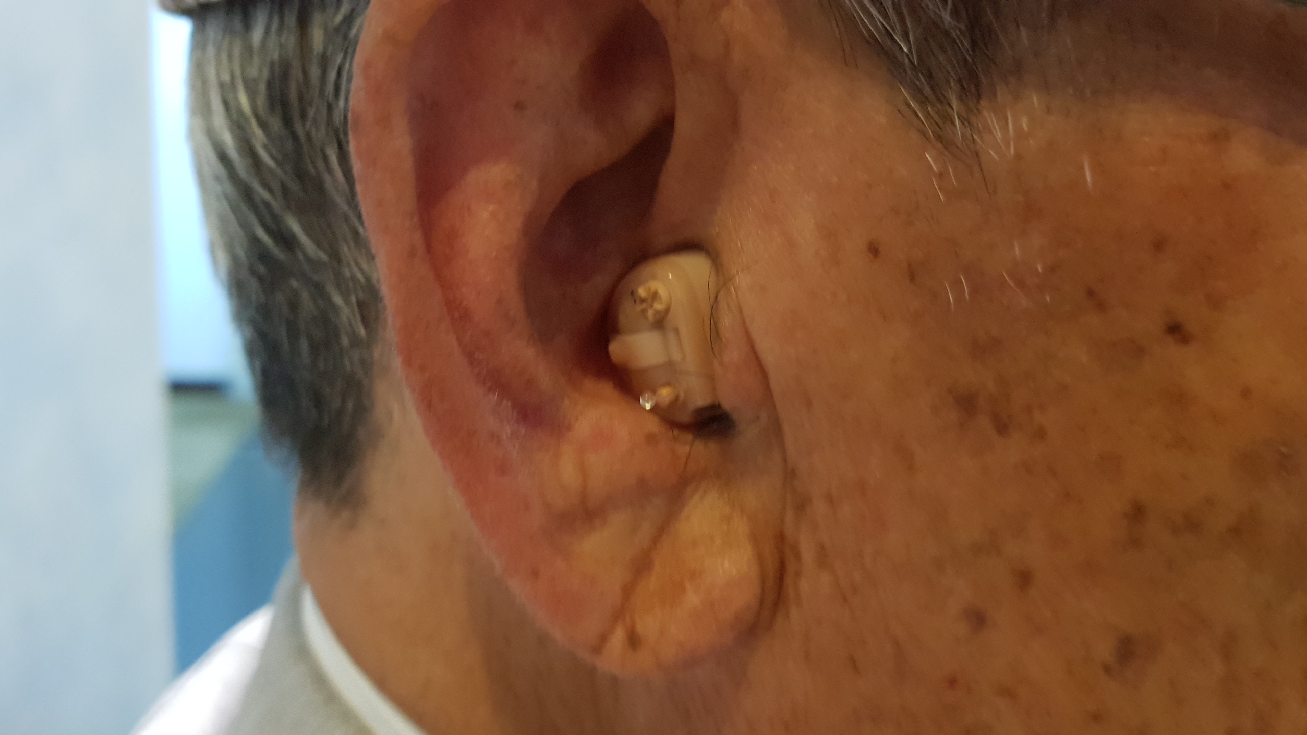 보청기 접근성&#44; 청각장애&#44; 보조청취장치&#44;보청기 법률과 제도&#44;보청기 피팅&#44;보청기사후관리&#44;보청기보험적용&#44;보청기표준제품&#44;의사소통&#44;