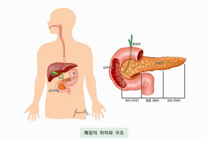 췌장암 초기 증상 총정리 조기 발견과 예방을 위한 완벽 가이드