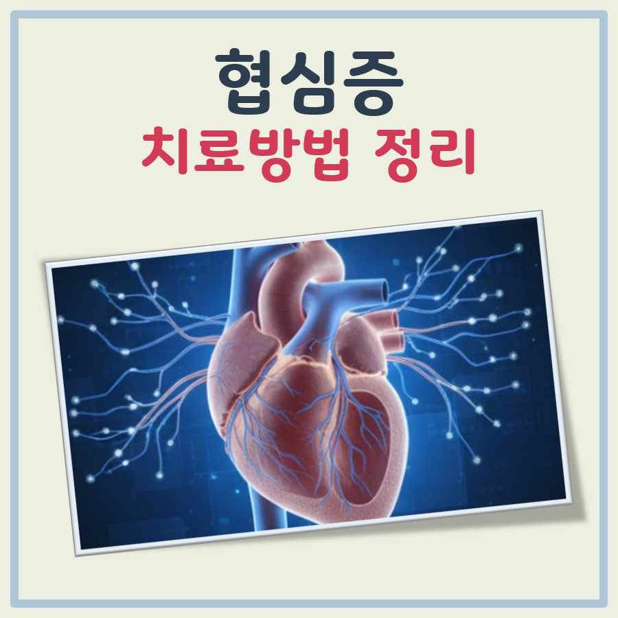 협심증 치료방법 대표 이미지
