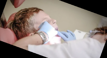 임플란트 가격 종류 비용