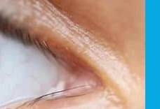 눈 영양제 구매 전 필수 정보 3가지, 루테인만 먹으면 안 되는 이유