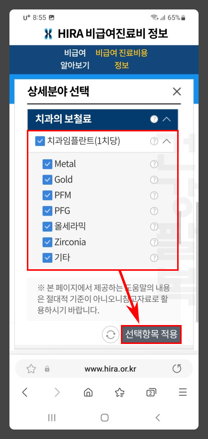 치과 임플란트 가격 확인