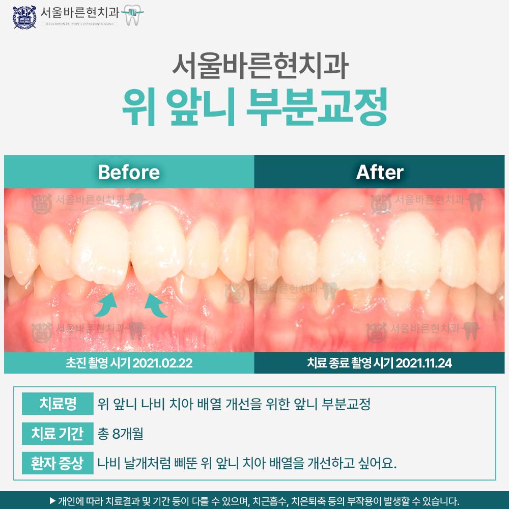 마린시티교정치과