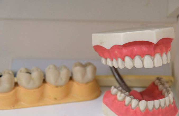 건강보험-적용되는-치과시술