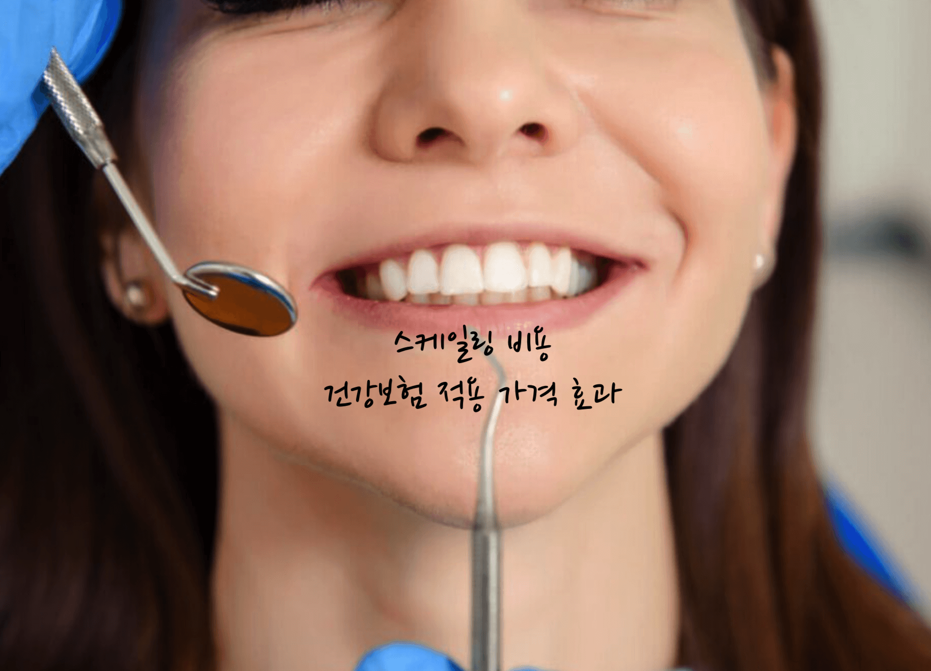 스케일링 비용