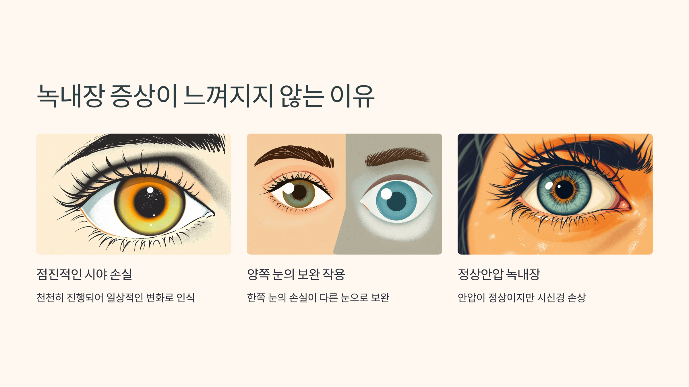 녹내장과 관련된 사진입니다.