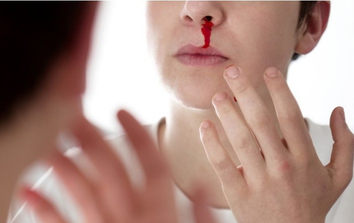 코피가-나는-이유