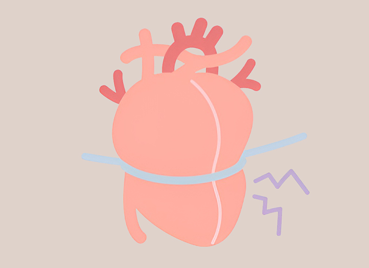 터질것-같은-심장