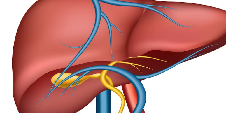 담도 폐색의 원인 담석