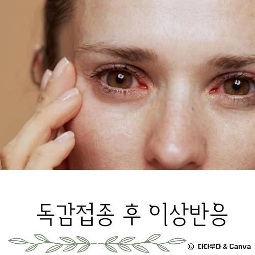 독감 접종후 증상 몸살 열 부으면 이상반응 생기면 신고