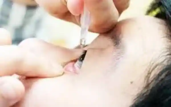 백내장 사진