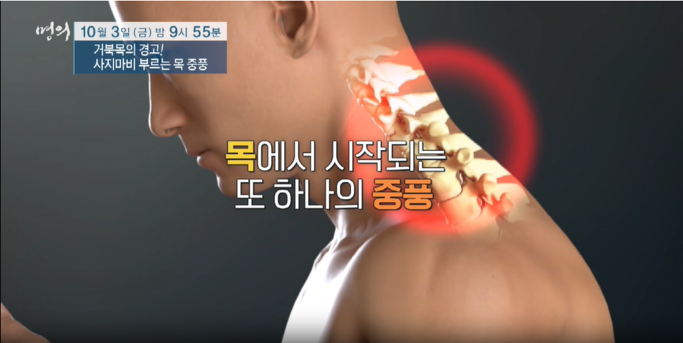 명의 거북목의 경고