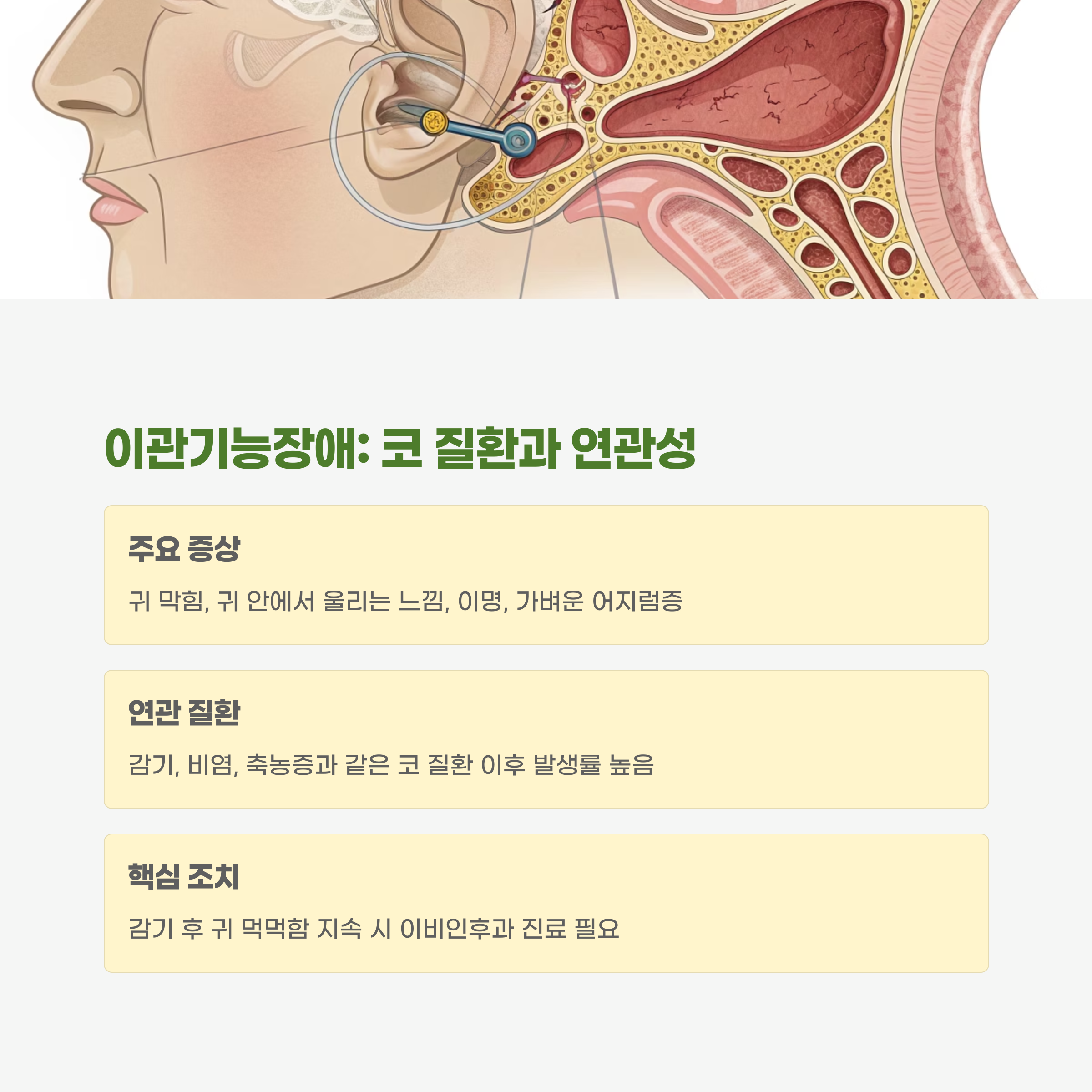 이관기능장애