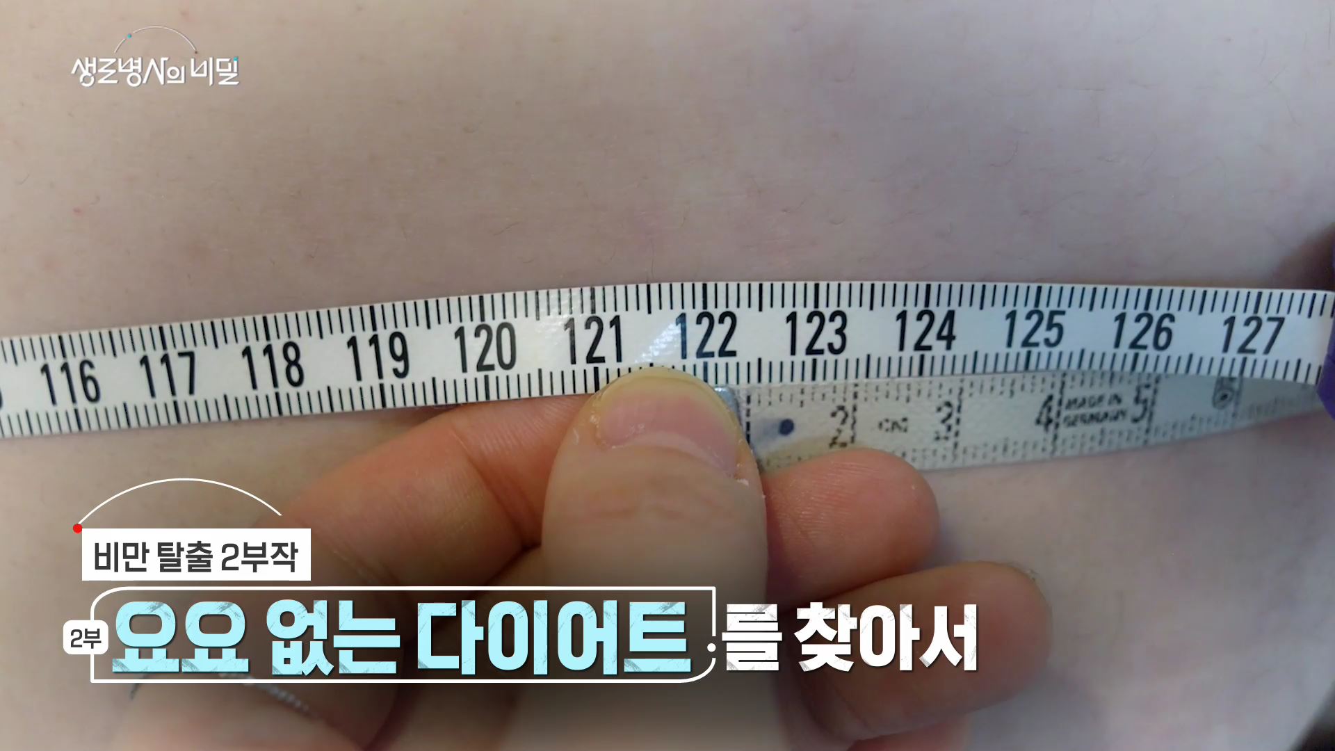 생로병사의 비밀