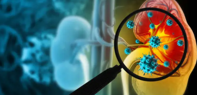 신장병과 관련된 사진