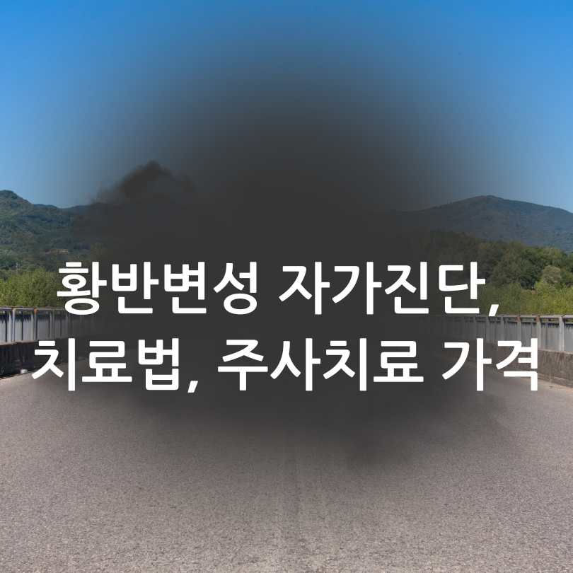 황반변성 자가진단, 치료법, 주사치료 가격