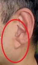 귀의 모습
