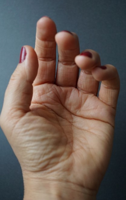 류마티스 관절염 초기 증상