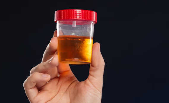 야간뇨은 어떻게 치료되나요?