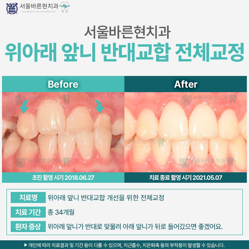 해운대교정치과