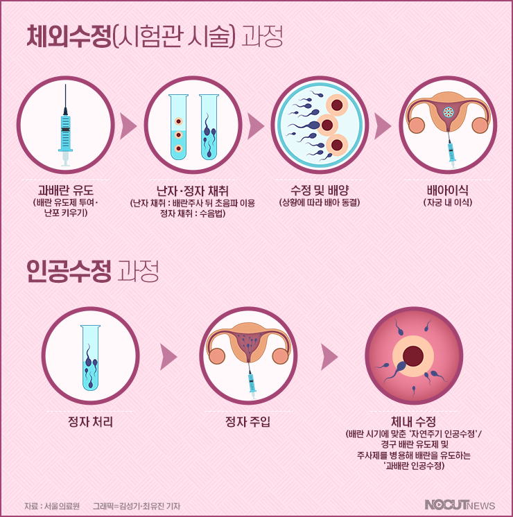 체외수정(시험관시술)과정 인포그래픽