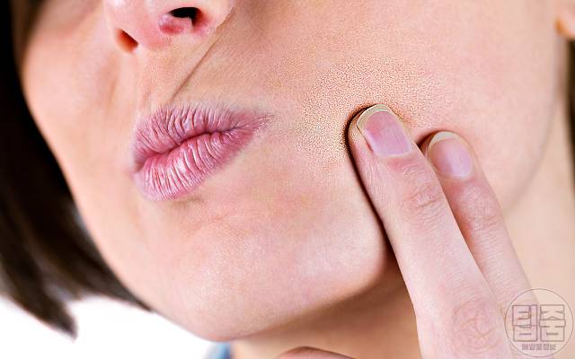 피부당김 얼굴당김 피부건조 가려움 원인