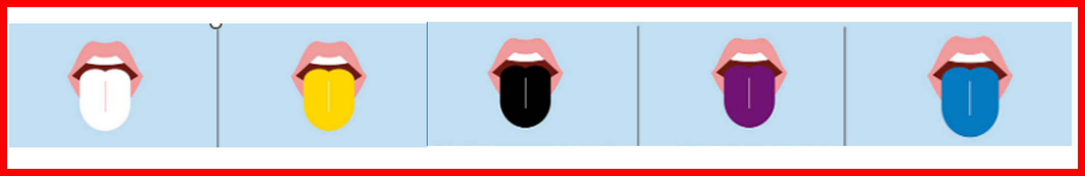 혀의 색깔로 알 수 있는 질병