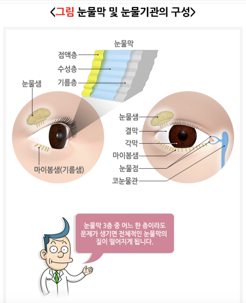 눈물막 구성