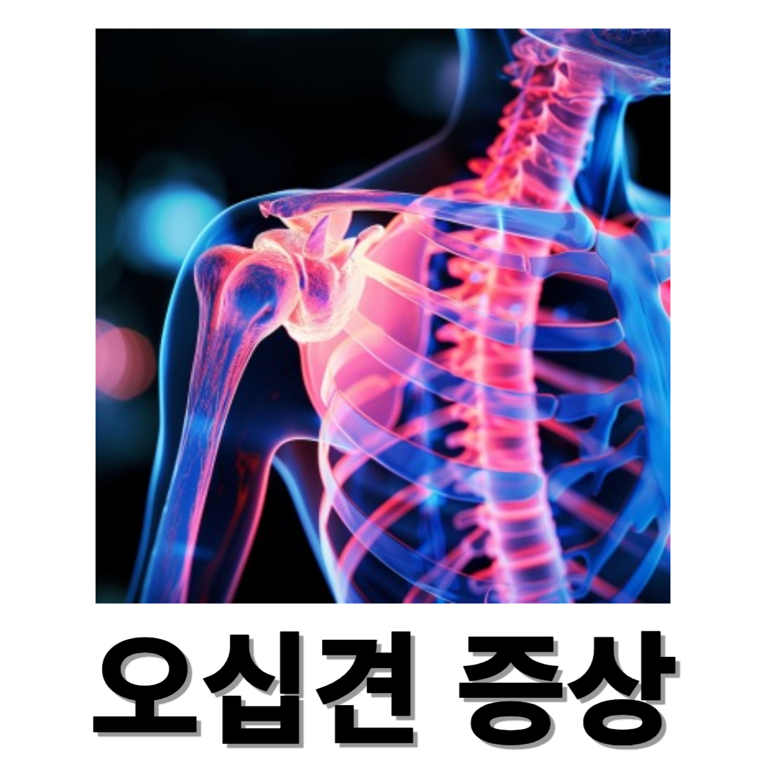 오십견과 관련된 사진입니다.