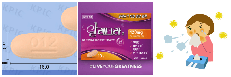 알레그라정&#44; 알레르기 사진