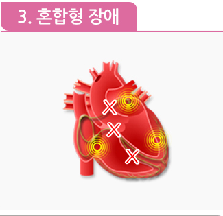부정맥 증상