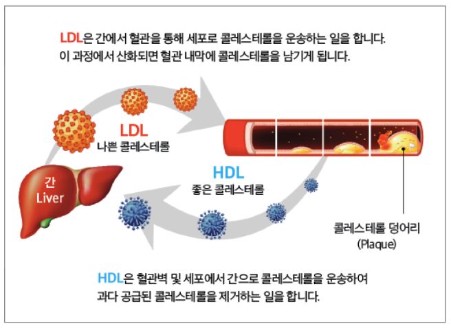 저밀도 콜레스테롤 이란