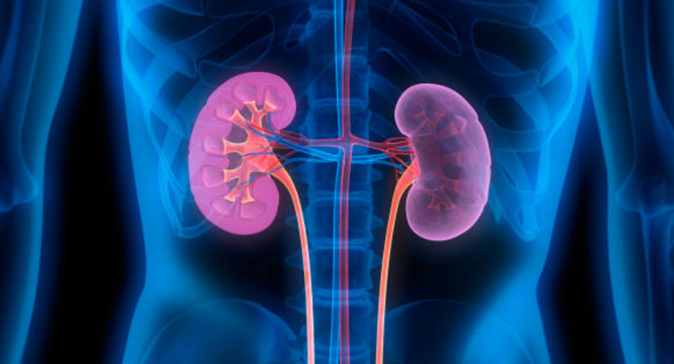 신장 질환 관련 사진