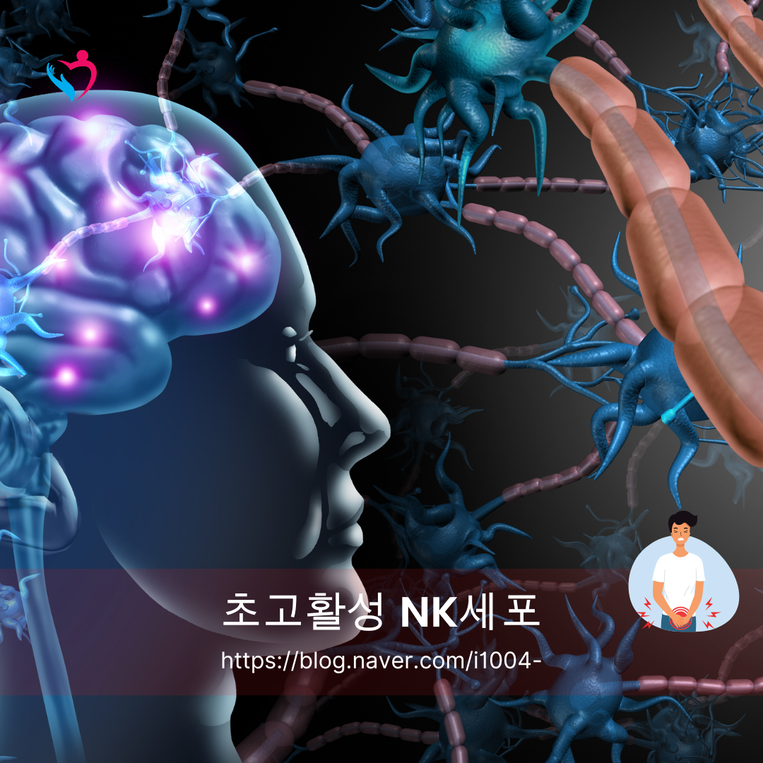 NK세포 암 예방 일본 치료에 대하여