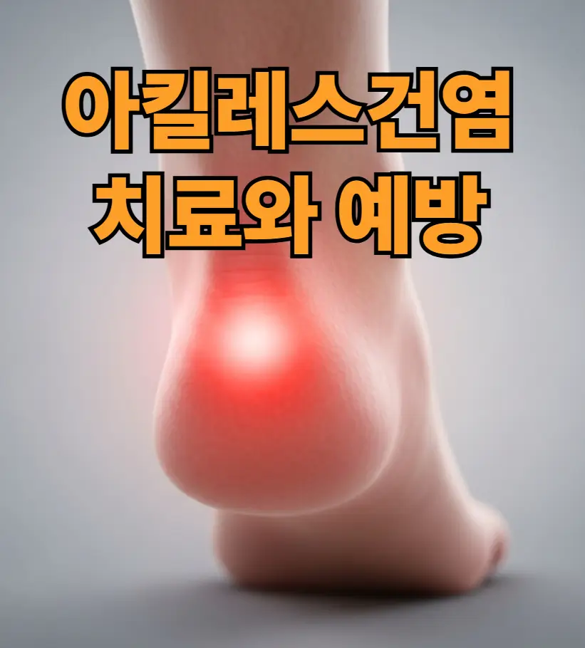 아킬레스건염 치료와 방