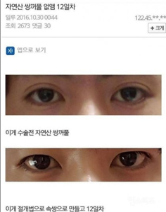 남자 쌍거플