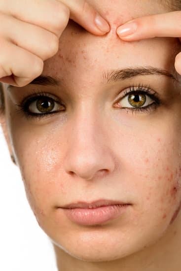 피부 트러블 응급 처치법: 빠르게 진정시키는 방법과 예방법