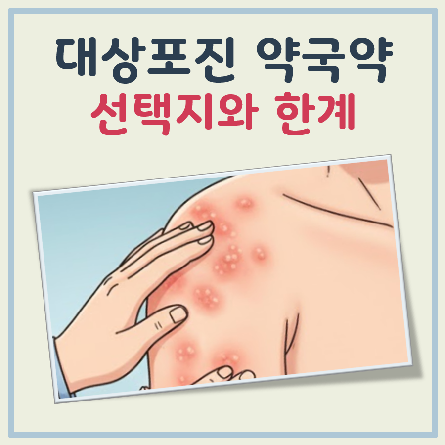 대상포진 약국약 대표 이미지
