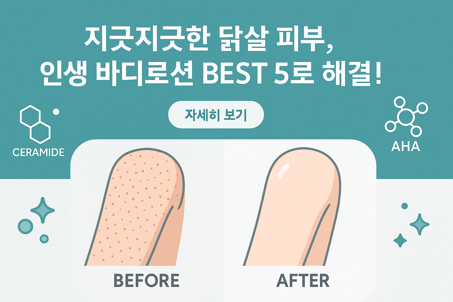 모공각화증으로 오돌토돌한 피부가 매끈하게 변하는 과정을 보여주는 일러스트. 이미지 중앙에는 '내돈내산! 성분 좋은 바디로션 추천 BEST 5'라는 글자가 쓰여 있고, 주변에는 세라마이드, AHA 등 주요 성분 아이콘이 배치되어 있음.