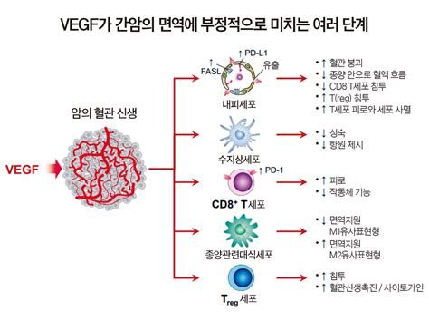 간암 생존율