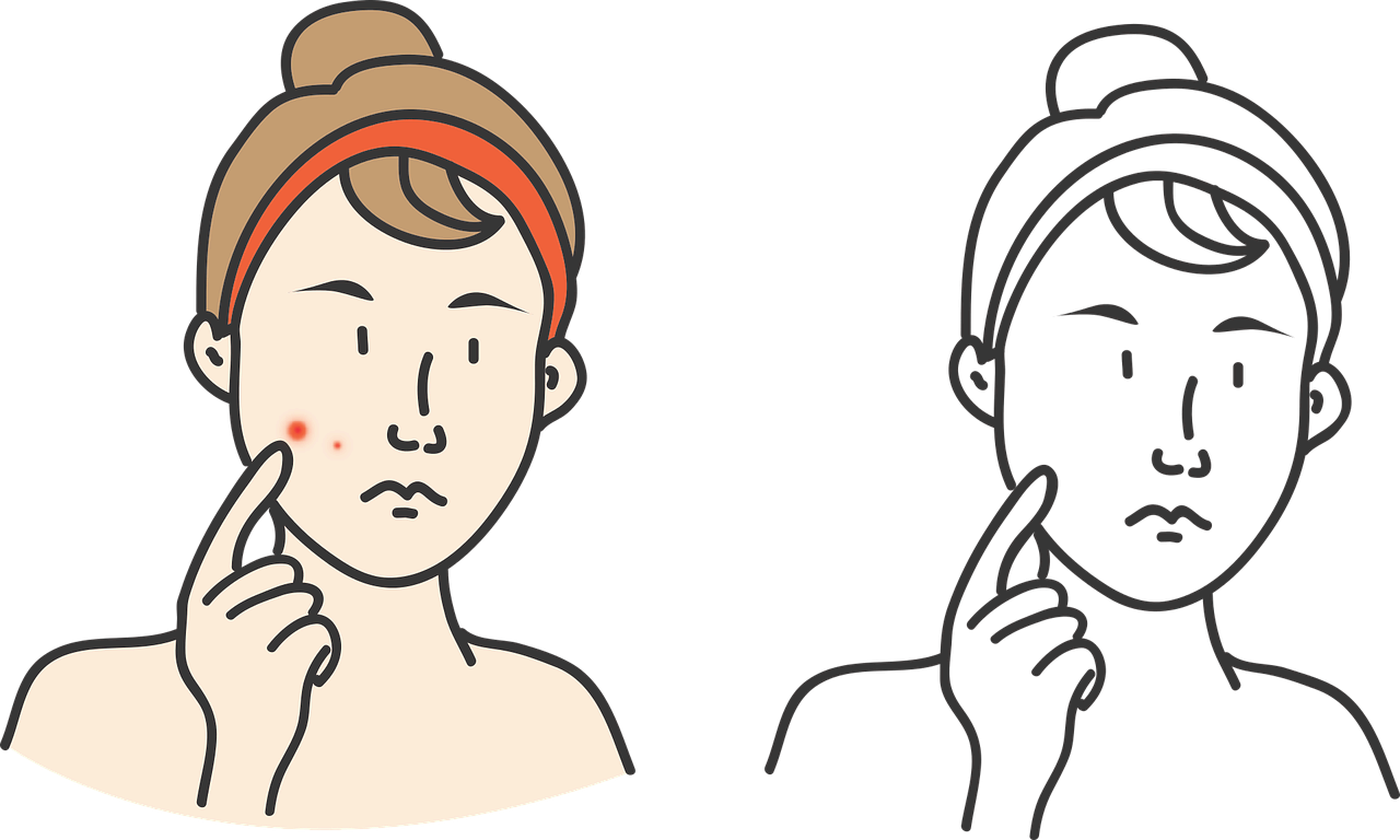 여드름 종류 총정리: 화농성, 비화농성, 결절성 여드름의 특징과 치료법