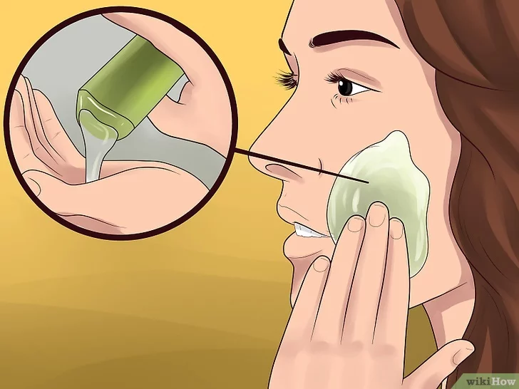 기미 잡티 제거